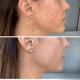 Complexion Cream Stick